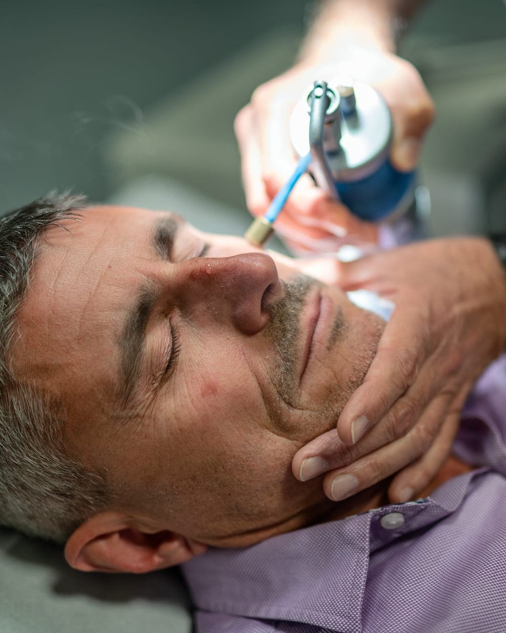 Practitioner treating a skin tag on a man's face